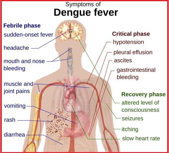 symptoms-of-dengue-fever