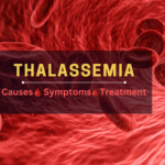 thalassemia-causes-symptoms-and-treatment